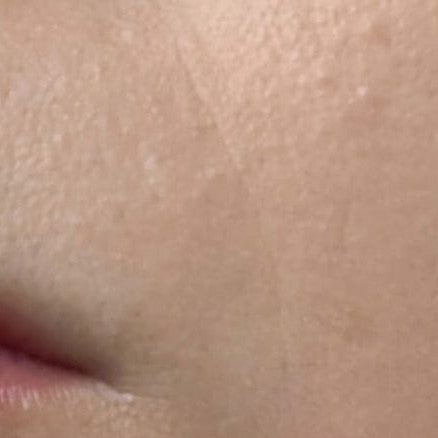 Juliettes Haut nach einem Monat Tallow-Pflege